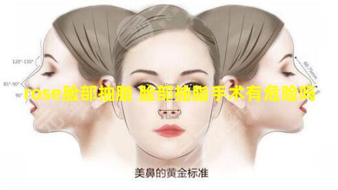 rose脸部抽脂 脸部抽脂手术有危险吗